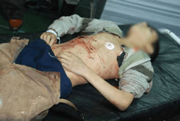 الطفل إبراهيم أيمن مبروك-27-01-2012.jpg